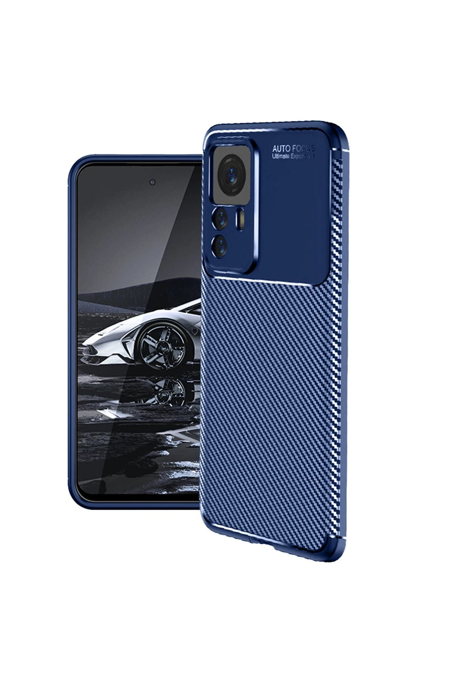 Newface Xiaomi Mi 12T Pro Kılıf Auto Focus Karbon Kapak - Lacivert