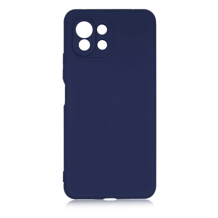 Xiaomi Mi 11 Lite Kılıf Zore Mara Lansman Kılıf - Lacivert