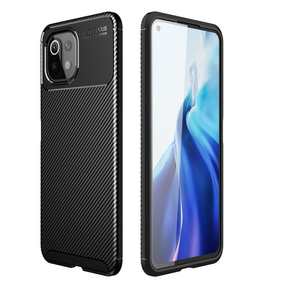 Xiaomi Mi 11 Lite Kılıf Zore Negro Silikon Kılıf - Siyah