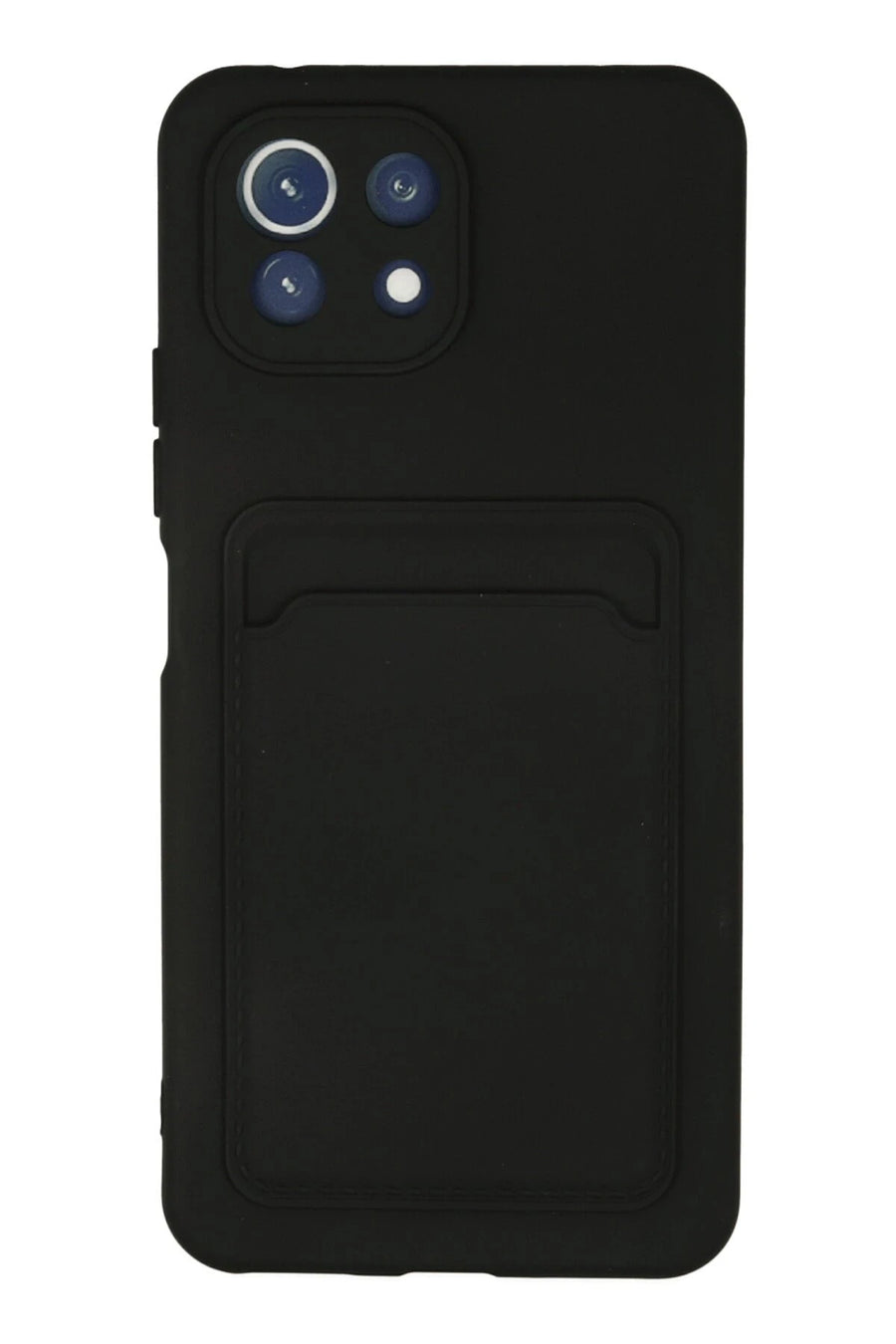 Newface Xiaomi Mi 11 Kılıf Kelvin Kartvizitli Silikon - Siyah