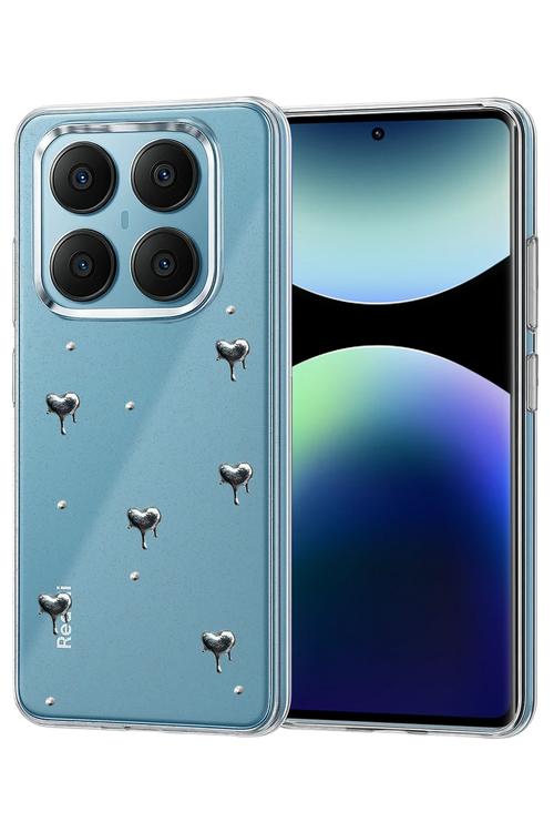 Newface Xiaomi Redmi Note 14 Pro 4G Fiyonk Desenli Kapak - Desen 1