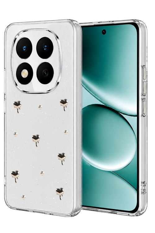 Newface Xiaomi Redmi Note 15 Pro 5G Fiyonk Desenli Kapak - Desen 1