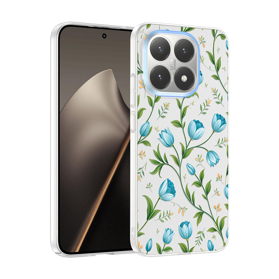 Xiaomi 15T Kılıf Kamera Korumalı Desenli Zore Klip Kılıf - Mavi Lale